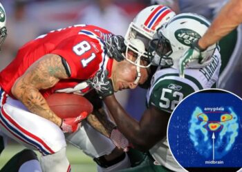 ‘Alarmingly high’ number of former NFL stars develop CTE, according to massive new study