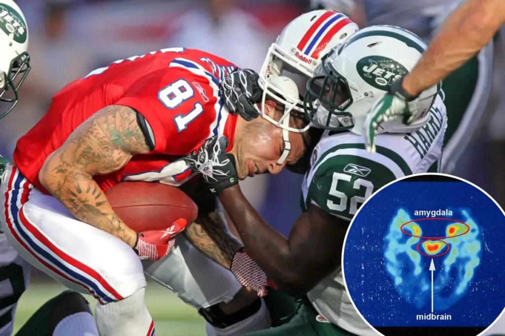 ‘Alarmingly high’ number of former NFL stars develop CTE, according to massive new study