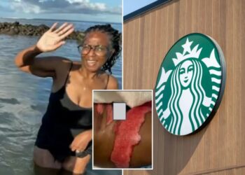 Starbucks horror as SoCal woman says boiling coffee spill led to surgery
