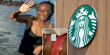 Starbucks horror as SoCal woman says boiling coffee spill led to surgery