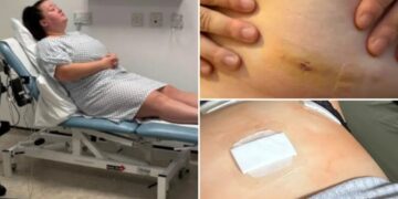 Doctors unnecessarily removed two of my organs before figuring out what was actually wrong with me