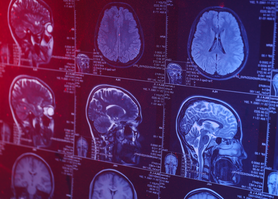 Your Skull Is Hiding a Secret Organ, and Scientists Just Found It