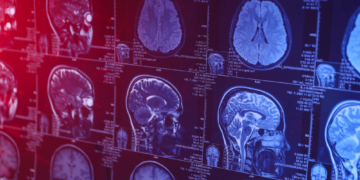 Your Skull Is Hiding a Secret Organ, and Scientists Just Found It