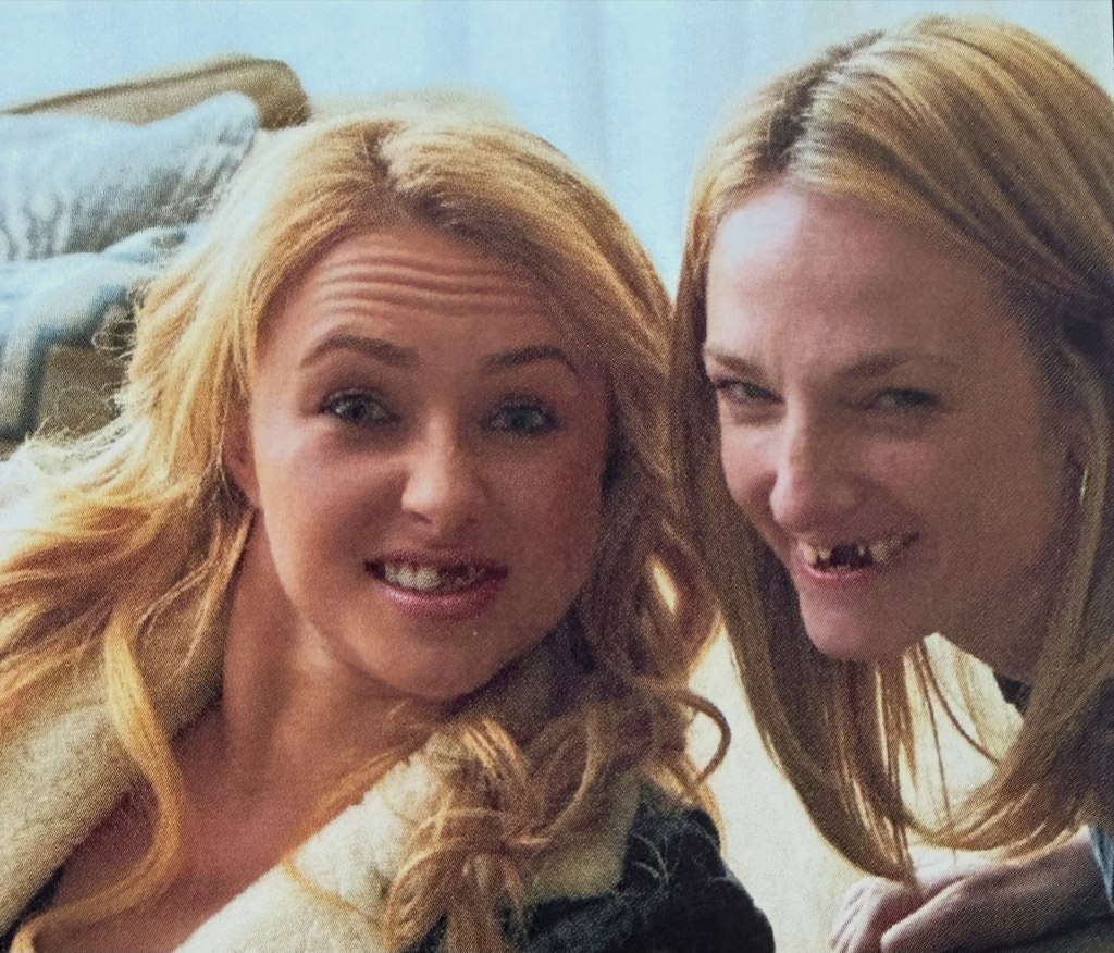 Sylvia Jeffries and Hayden Panettiere smiling, with missing teeth prosthetics.