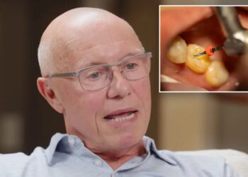 Silicon Valley billionaire got root canal without Novocaine to see if he was a ‘badass’