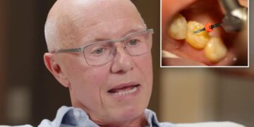 Silicon Valley billionaire got root canal without Novocaine to see if he was a ‘badass’