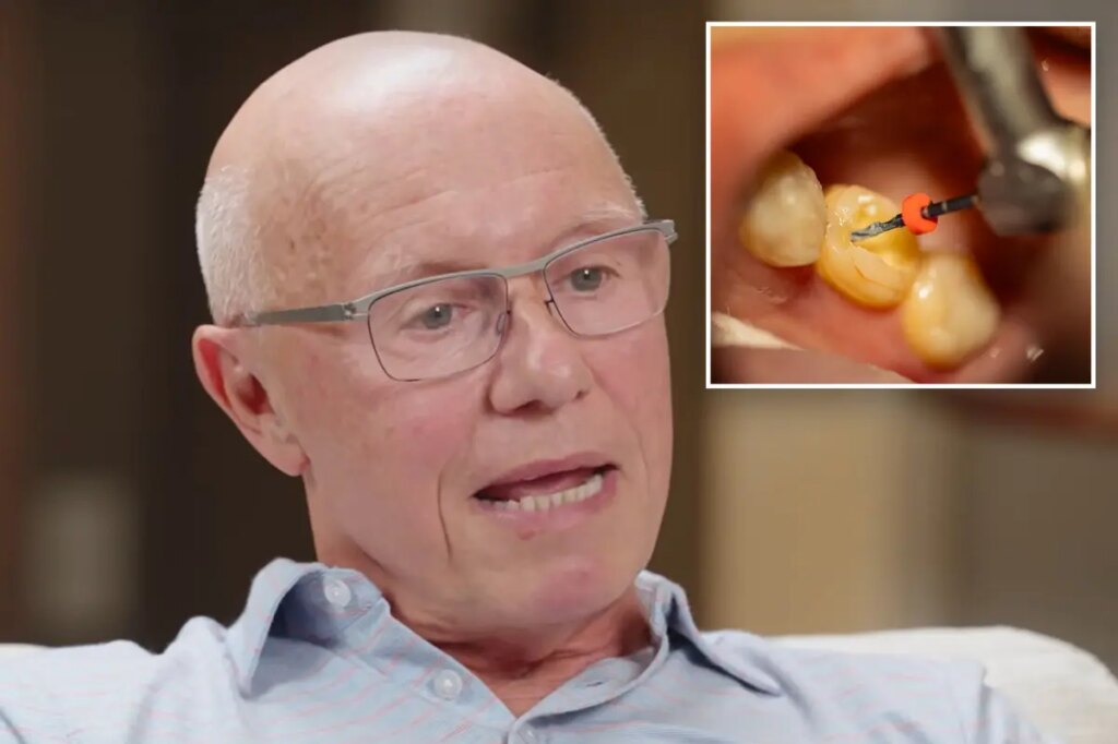 Silicon Valley billionaire got root canal without Novocaine to see if he was a ‘badass’