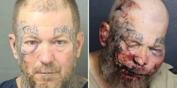 Florida man left with swollen face in mugshot after attacking cop inside hospital: ‘I want to fight you’
