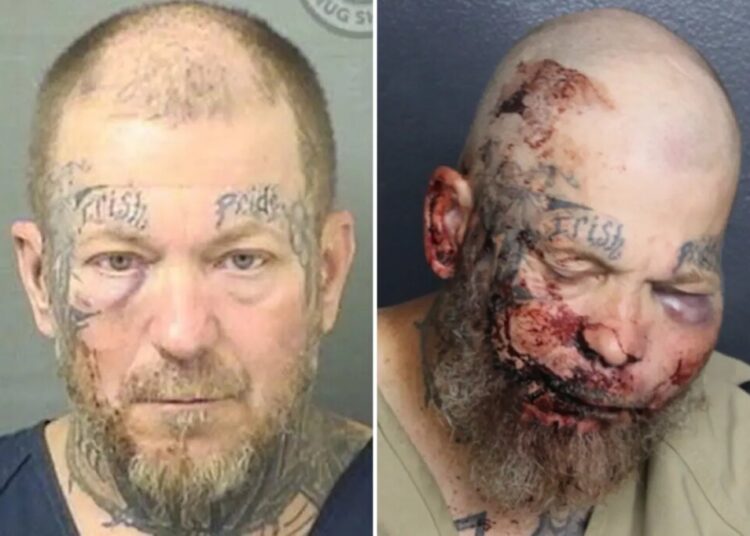 Florida man left with swollen face in mugshot after attacking cop inside hospital: ‘I want to fight you’