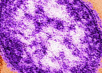Six-Week-Old Infant Died From Measles, Lancaster Coroner Says
