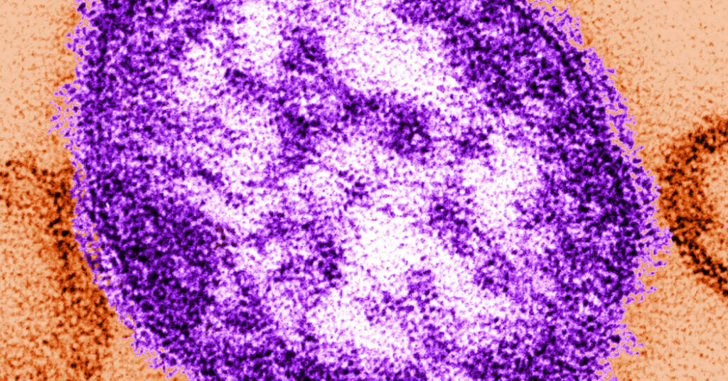 Six-Week-Old Infant Died From Measles, Lancaster Coroner Says