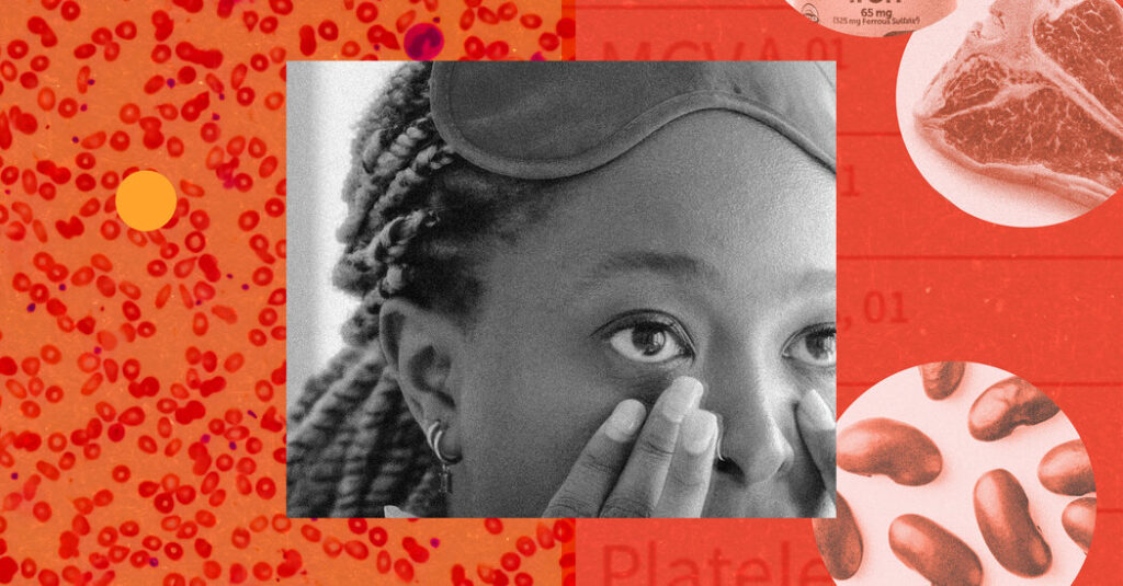 Fatigue? Dark Circles? How to Tell if It’s Iron Deficiency.
