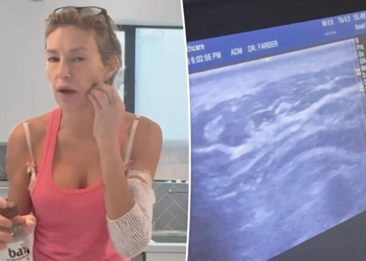 Brandi Glanville saw ‘something alive’ and ‘moving’ in her face in horrifying ultrasound