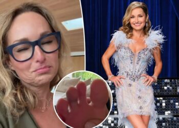 Giada De Laurentiis reveals gnarly injury ahead of ‘Dancing With the Stars’ premiere: ‘For sure gonna lose my toenail’