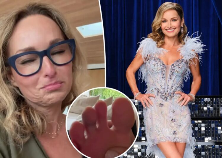 Giada De Laurentiis reveals gnarly injury ahead of ‘Dancing With the Stars’ premiere: ‘For sure gonna lose my toenail’