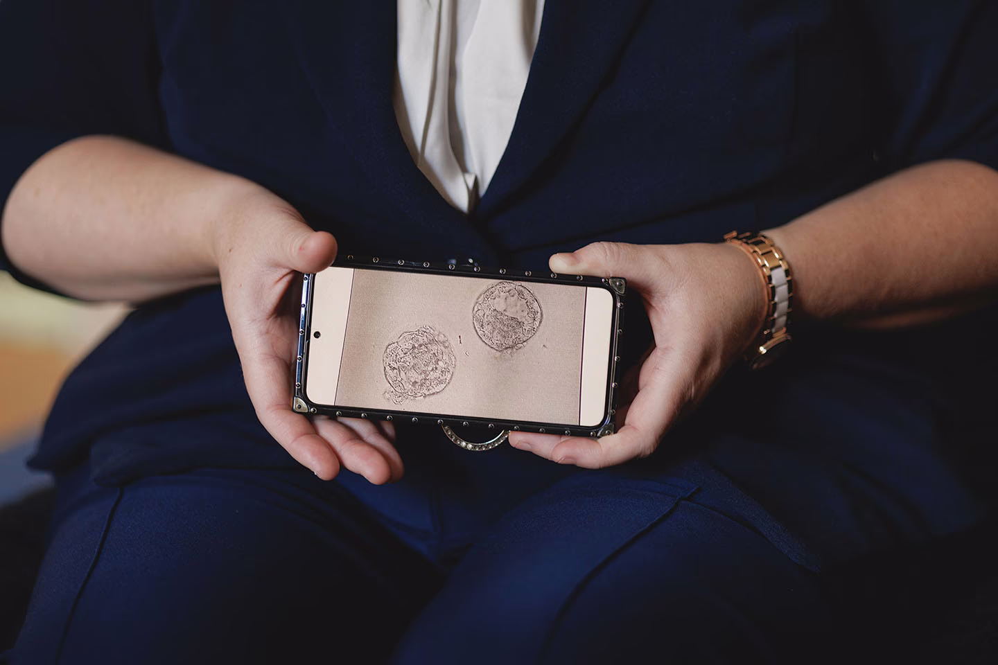 photo of woman's hands holding phone with image of two embryos as cells