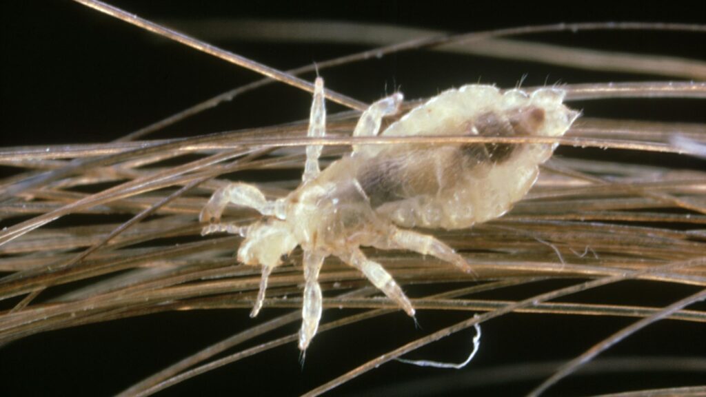 It’s Head Lice Season. Here’s What to Know