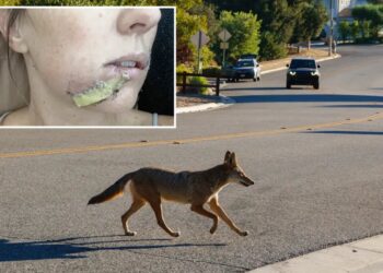 Arizona mom fights off crazed coyote with flip-flip after wild animal attacks 4-year-old daughter