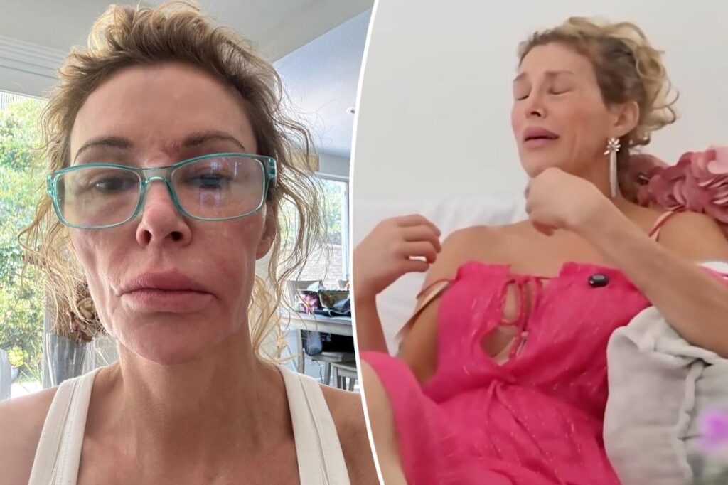 ‘Embarrassed’ Brandi Glanville breaks down in tears over GoFundMe: ‘I never thought I would do this’