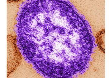Pennsylvania officials report state’s 3rd death involving measles