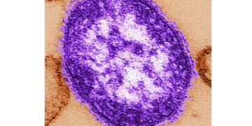 Pennsylvania officials report state’s 3rd death involving measles