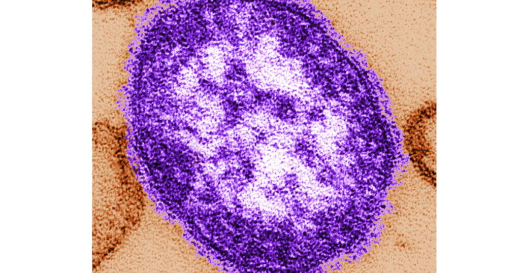 Pennsylvania officials report state’s 3rd death involving measles