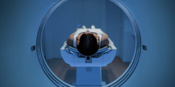 I’m a doctor. Here’s why I wouldn’t get a full-body MRI scan.