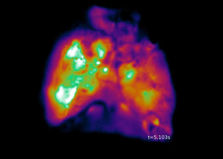These Mice Have Partly Human Brains