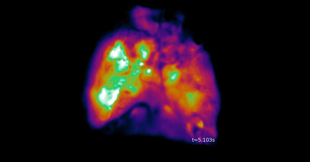 These Mice Have Partly Human Brains