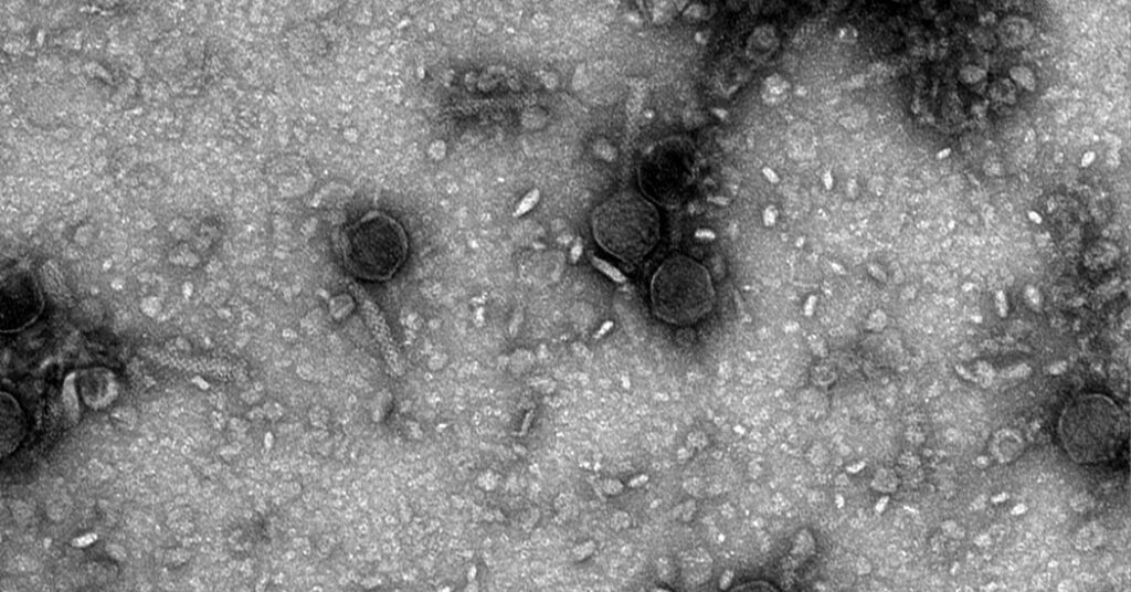 The Next Gene-Editing Technology May Also Be the Oldest