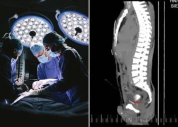 Doctors find shocking ‘foreign bodies’ inside a man’s chest, pelvis, bladder — and penis