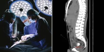 Doctors find shocking ‘foreign bodies’ inside a man’s chest, pelvis, bladder — and penis