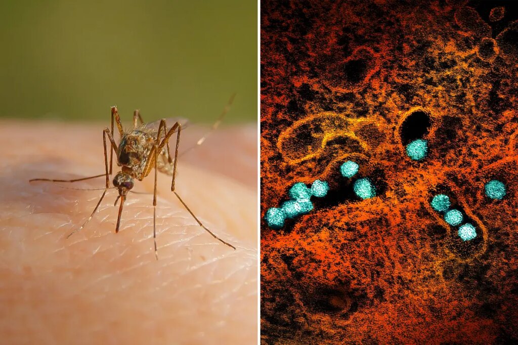 Cases of West Nile virus soar in NYC, surpassing total number in 2025