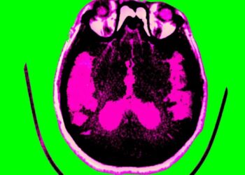 Scientists are finally starting to figure out Alzheimer’s