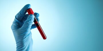 Who Should Get a Blood Test for Alzheimer’s Disease?