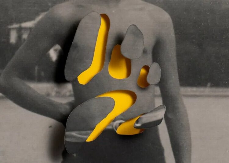 The State of Organ Donation