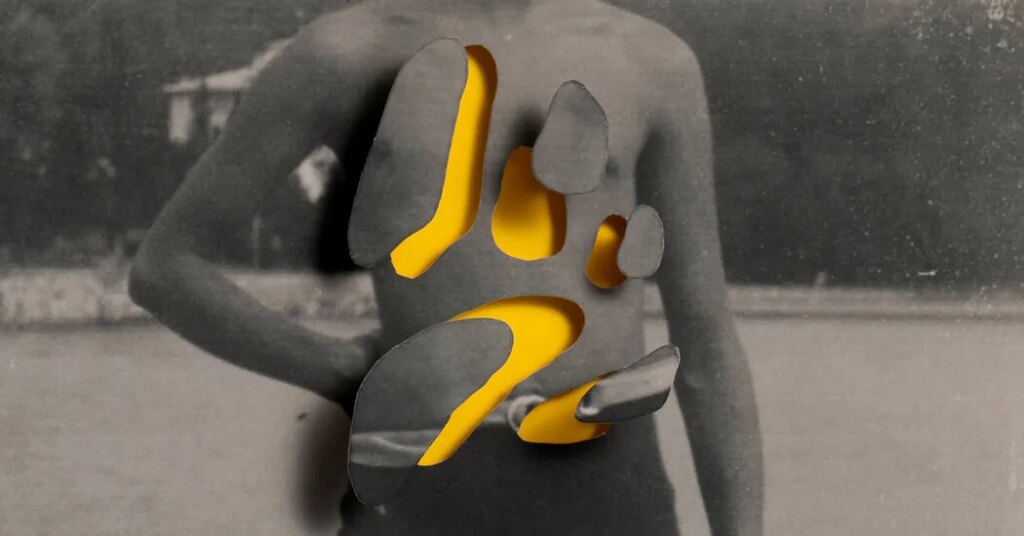 The State of Organ Donation