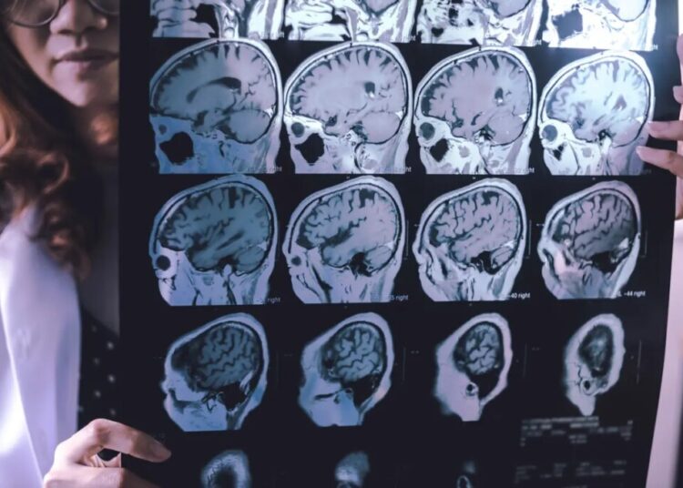 This family’s heartbreaking struggle with dementia in midlife may upend our understanding of the disease — and hope for a cure