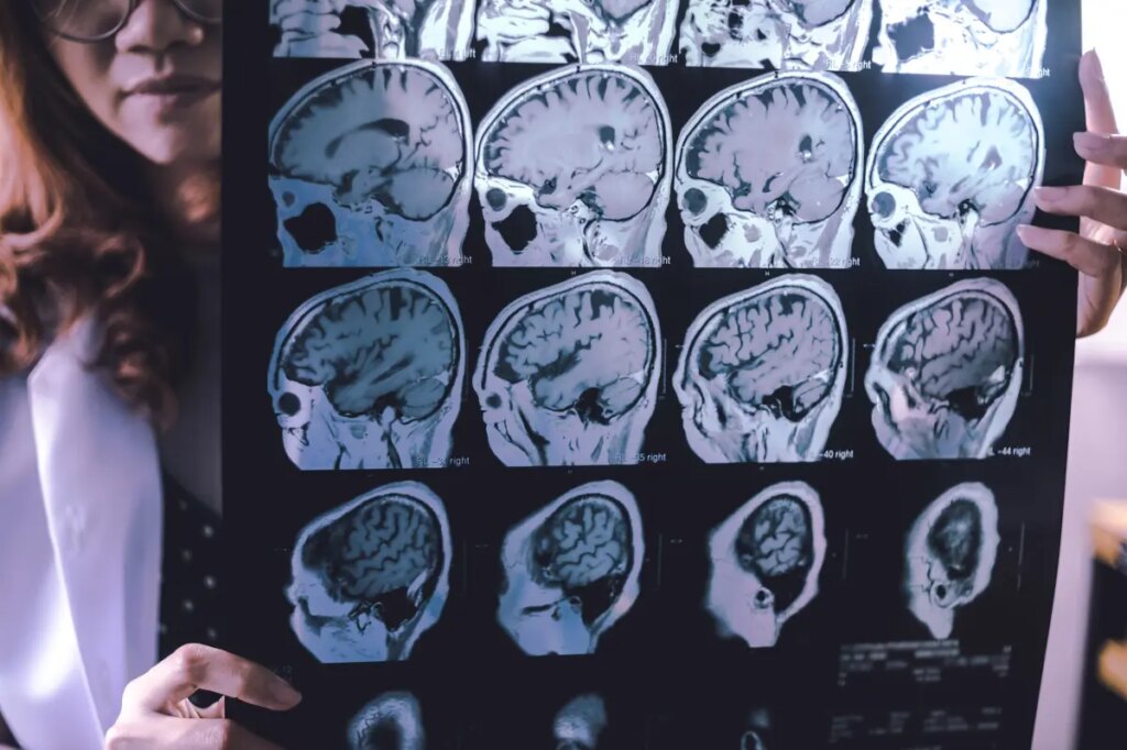 This family’s heartbreaking struggle with dementia in midlife may upend our understanding of the disease — and hope for a cure