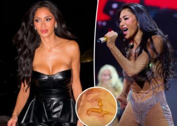 Nicole Scherzinger shows off gruesome injury after ‘boiling water’ fell on her leg 1 hour before concert