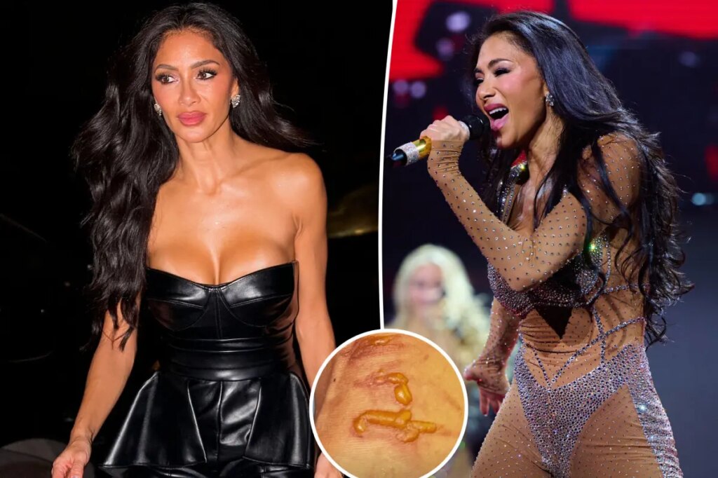 Nicole Scherzinger shows off gruesome injury after ‘boiling water’ fell on her leg 1 hour before concert