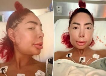 Farrah Abraham unrecognizable after jaw surgery leaves her face severely swollen