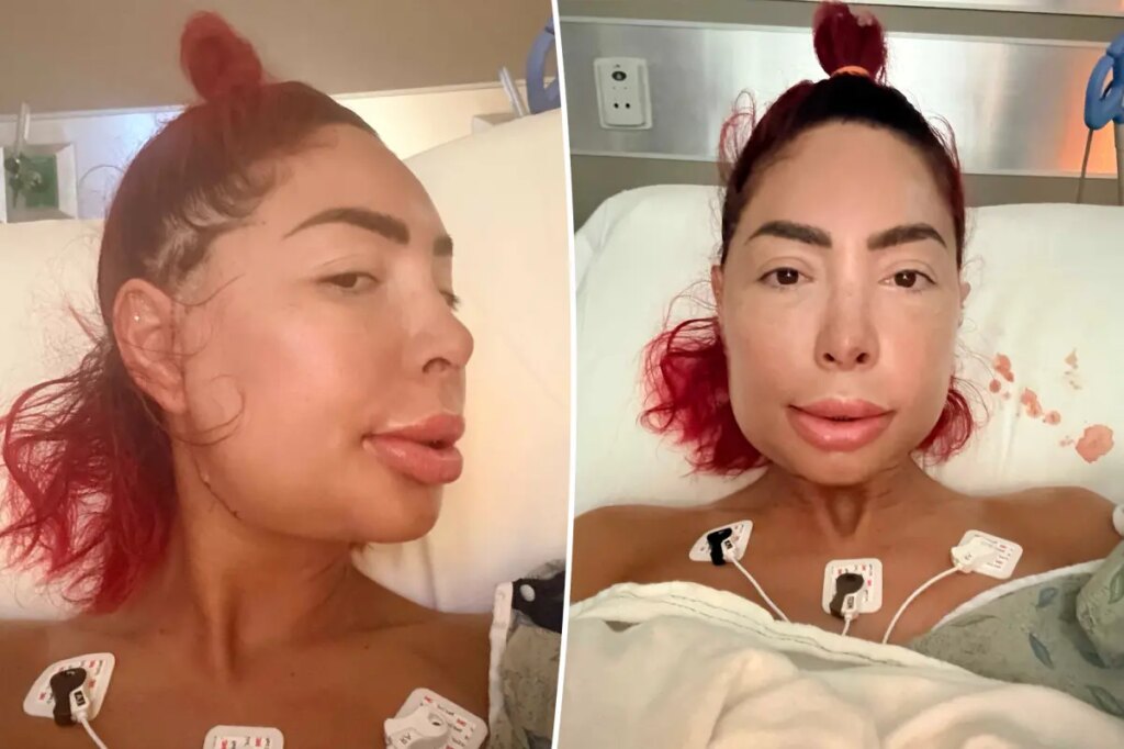 Farrah Abraham unrecognizable after jaw surgery leaves her face severely swollen