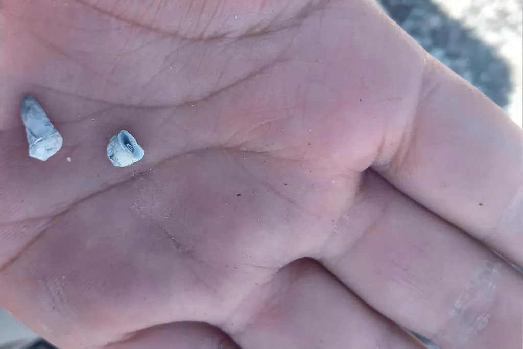 Two small, discolored baby teeth resting on a person's palm.