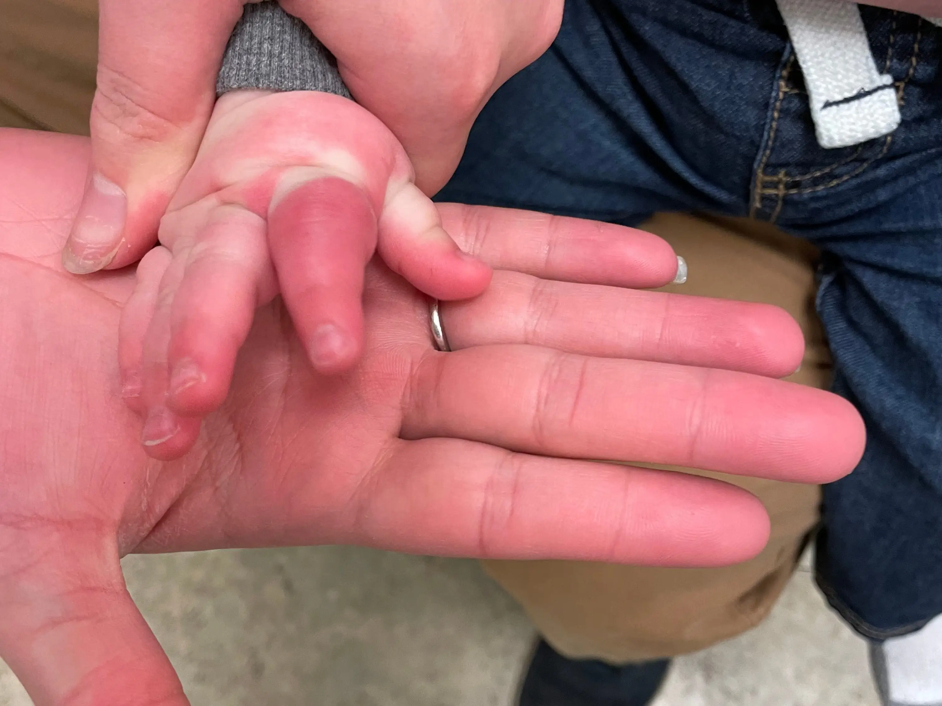 An infant's hand is being examined by a medic.