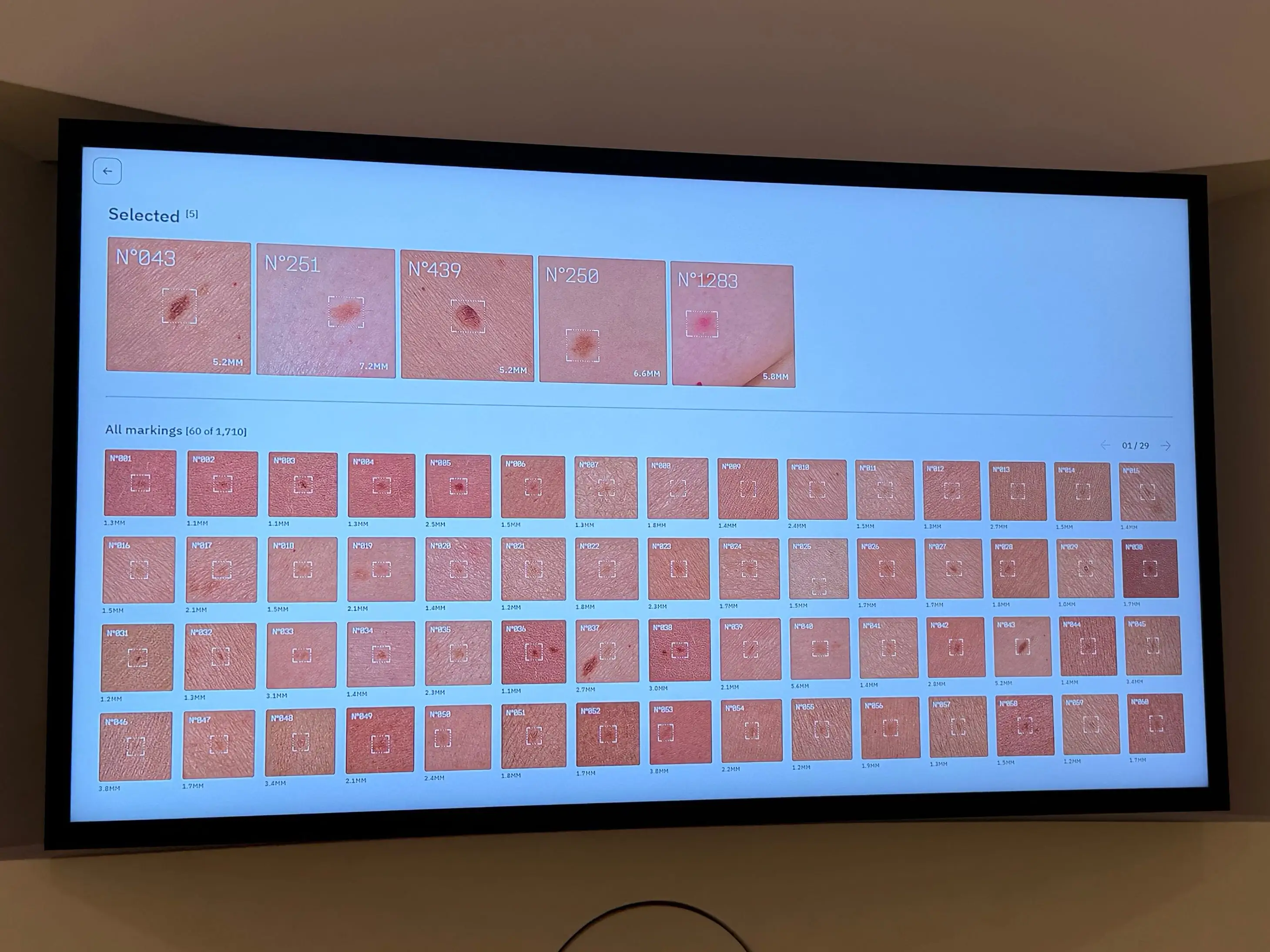 skin scan