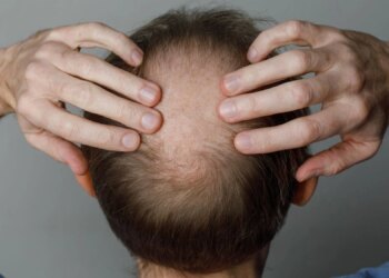 Does Ozempic Really Make You Lose Your Hair? Here’s What New Research Suggests.
