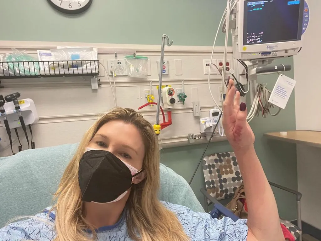 Brandi Glanville in a hospital bed with a black face mask, holding up her injured left hand.
