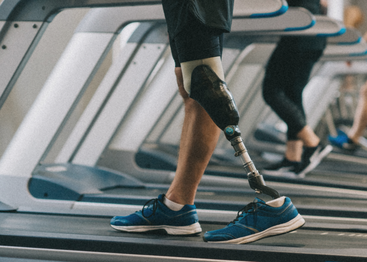 This Artificial Skin Could Make Prosthetic Limbs Safer by Mimicking Pain