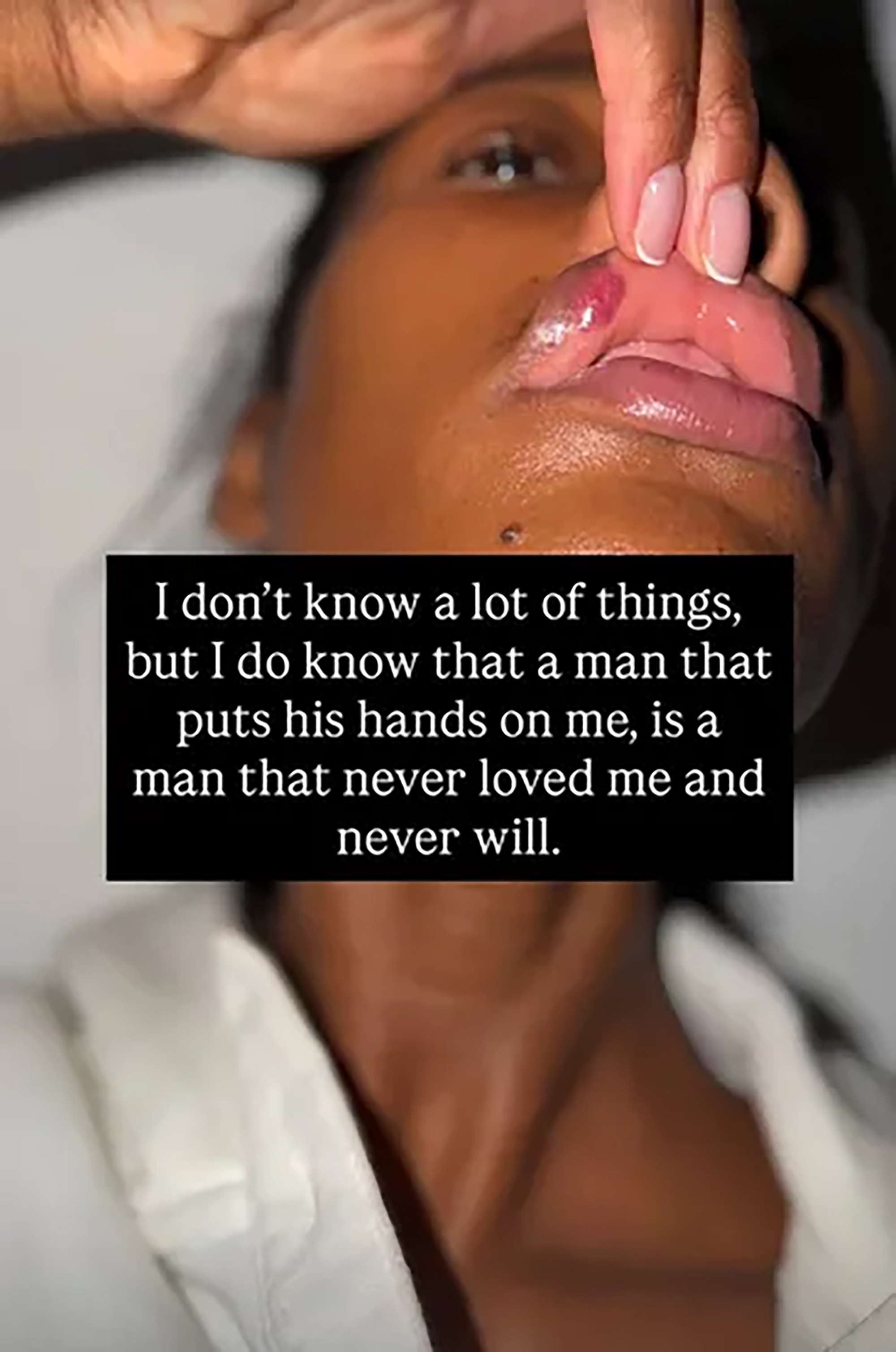 A woman shows a visible injury on her upper lip, above text about domestic violence.